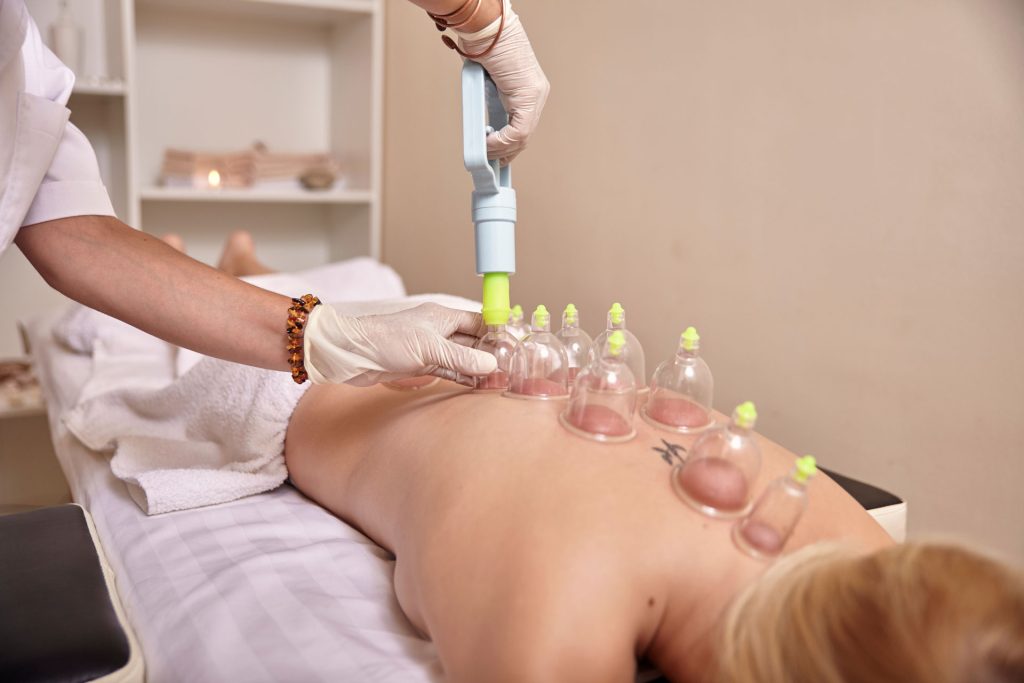 ⁠formation cupping thérapie genève